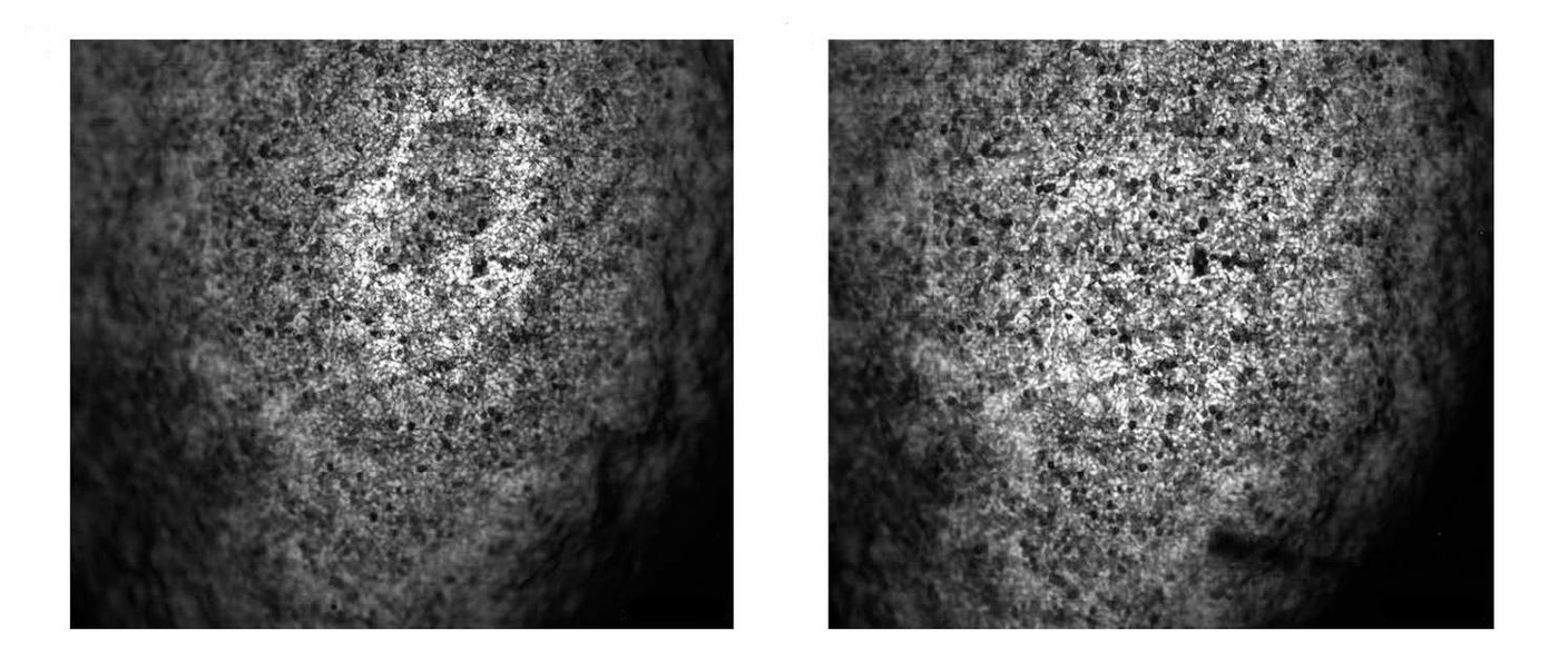 two images showing mouse liver tissue. In the image at the right, structures are in focus over a greater range of depth.