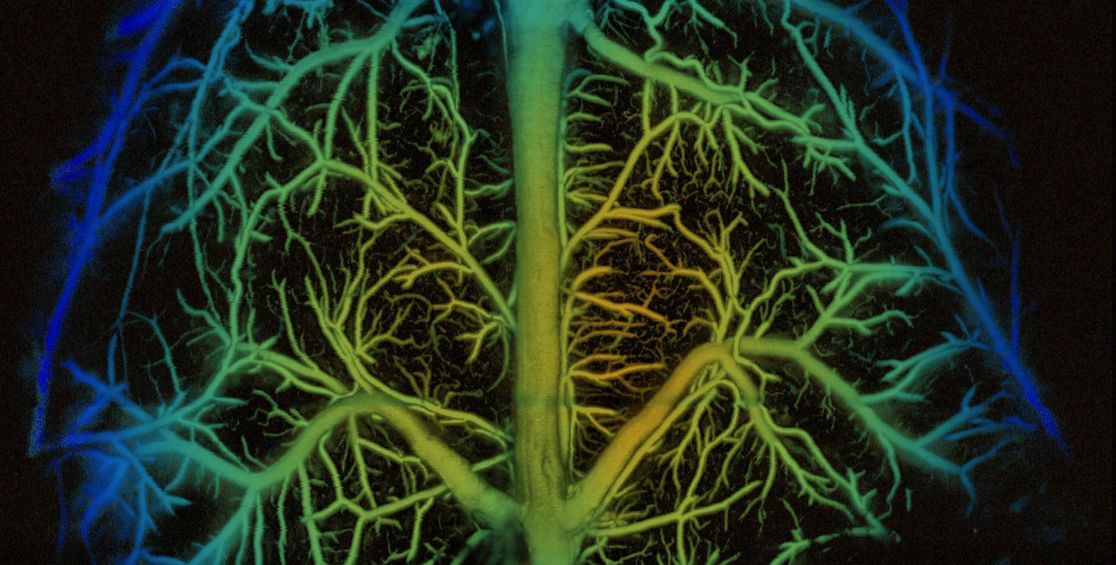 A computer-generated image of the tangled blood vessels of a mouse's brain.