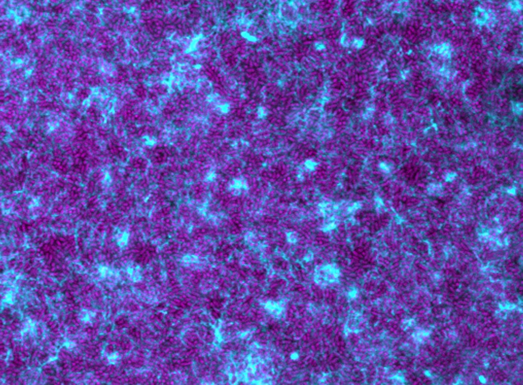 Many purple pill shapes among a web of blue