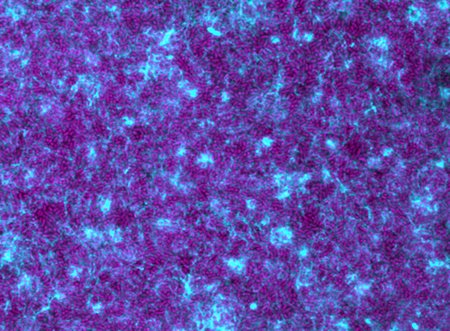 細菌バイオフィルム防御機構に新見解(A New Perspective on Bacterial Biofilm Defenses)