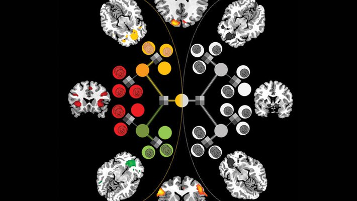 fMRI scans of brain regions involved in value judgements