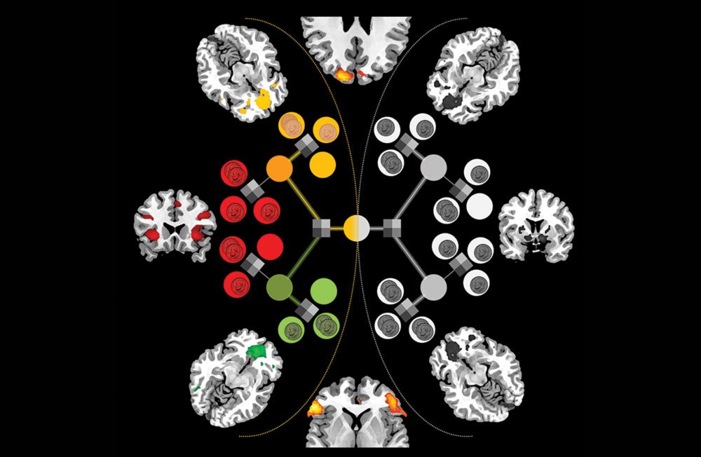 fMRI scans of brain regions involved in value judgements