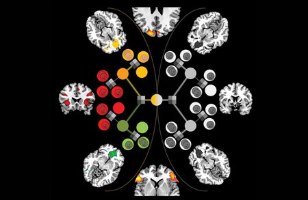 fMRI scans of brain regions involved in value judgements