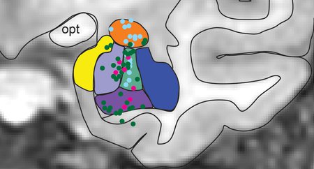 An image of a region of the brain overlaid with different colors.