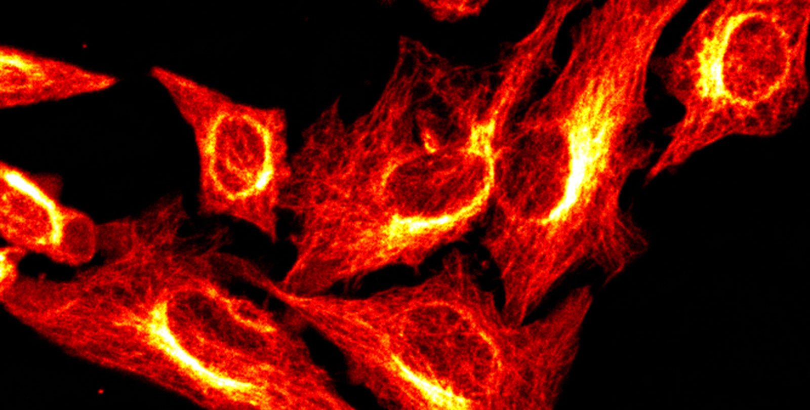 Irregularly shaped cells appear to glow against a dark field.