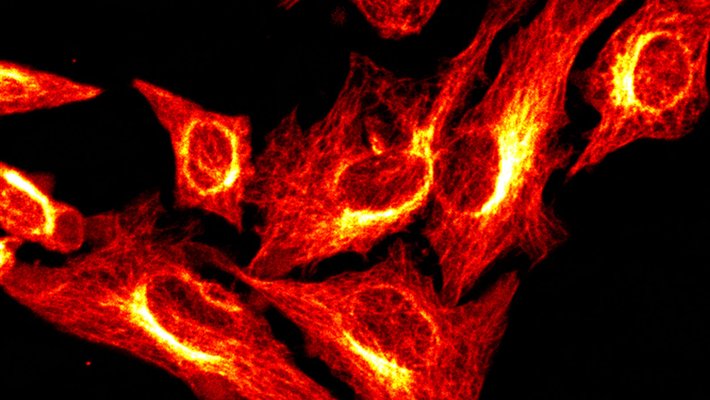 Irregularly shaped cells appear to glow against a dark field.