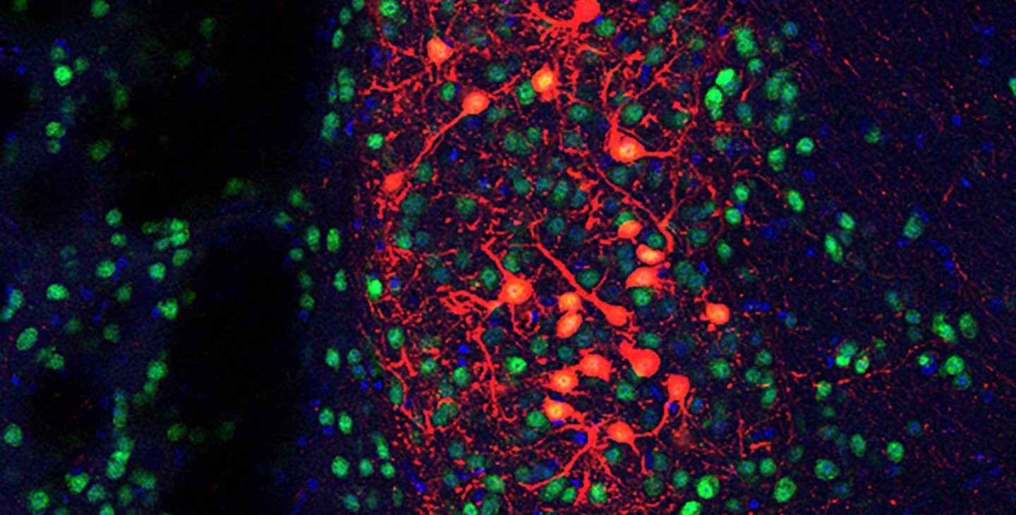 A web of neurons stained red, blue, and green