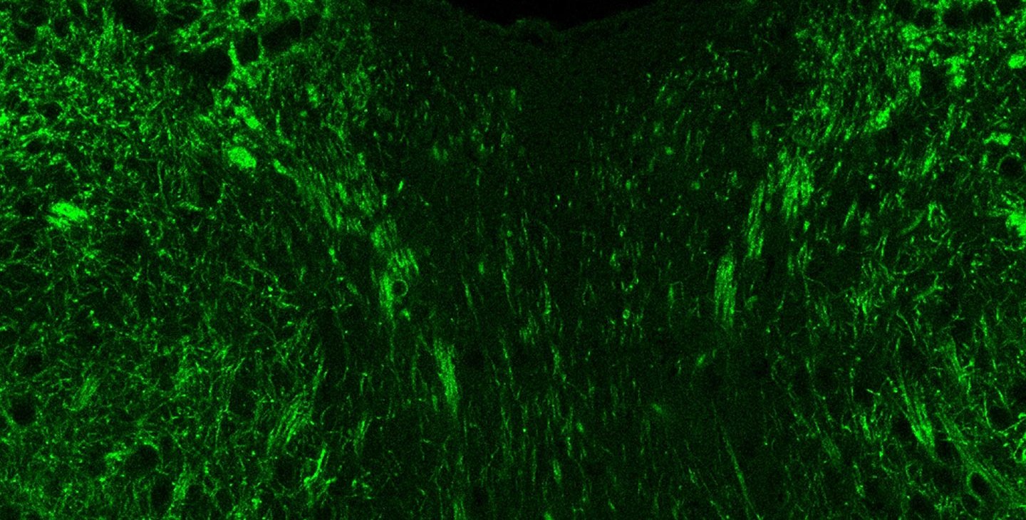 Bright green dots on a black background