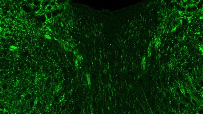 Bright green dots on a black background