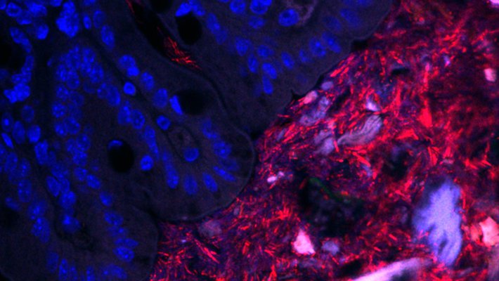 An image of bacteria within a mouse colon