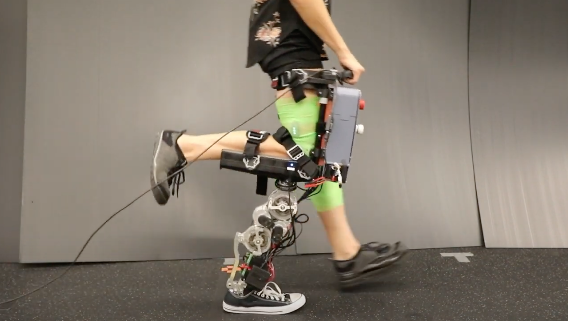 Powered Prosthetic