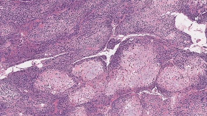 A field of cells shown at a microscopic level