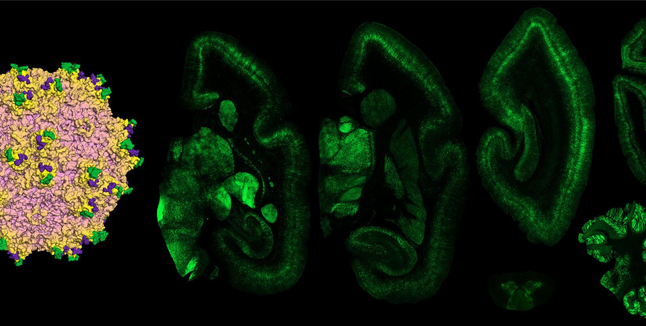 Capsid and brain regions