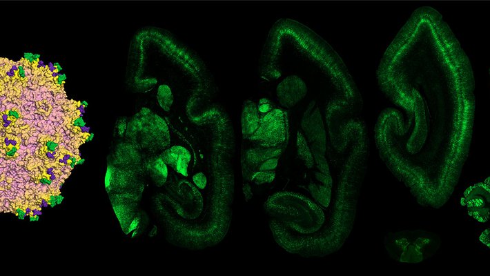 Capsid and brain regions