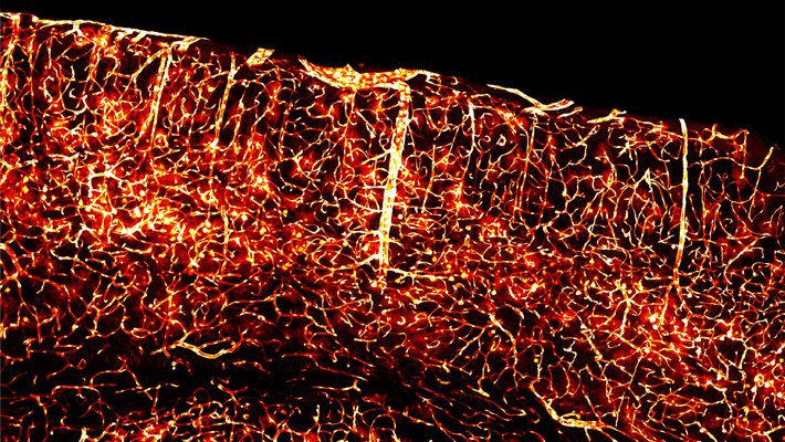 Glowing brain vasculature is made possible through