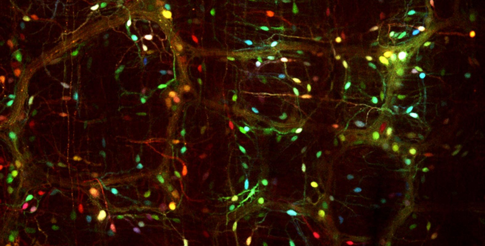 Cells of the enteric nervous system are given colorful labels through viral vectors