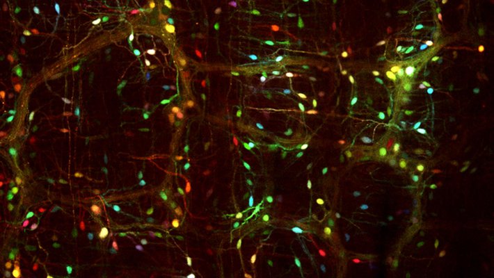 Cells of the enteric nervous system are given colorful labels through viral vectors