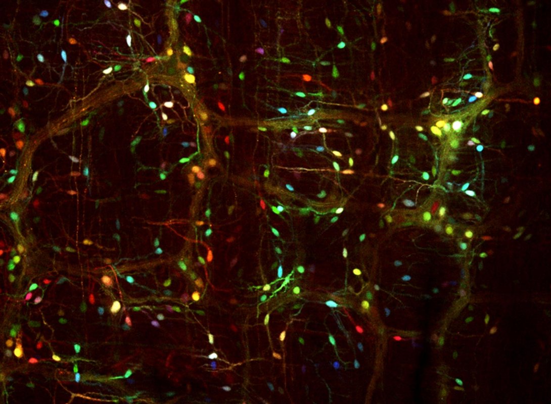 Cells of the enteric nervous system are given colorful labels through viral vectors