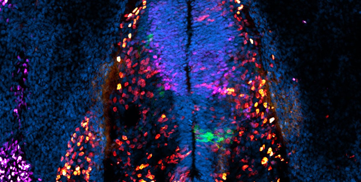 A colorful microscope image of the cells of the spinal cord of a chicken embryo.