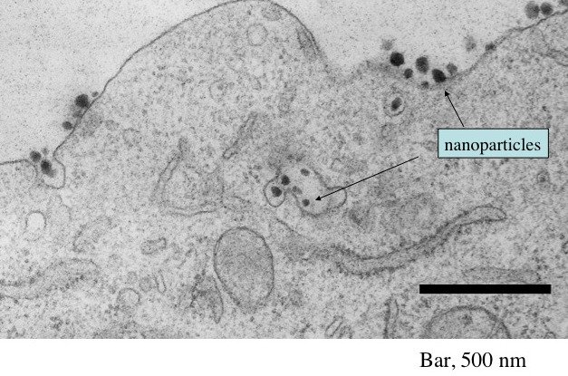 An electron micrograph showing the presence of numerous siRNA-containing targeted nanoparticles both entering and within a tumor cell