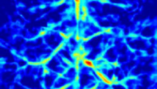 A false-color image of the blood vessels inside a mouse's brain.