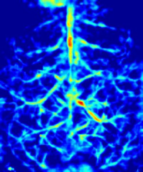 A false-color image of the blood vessels inside a mouse's brain.