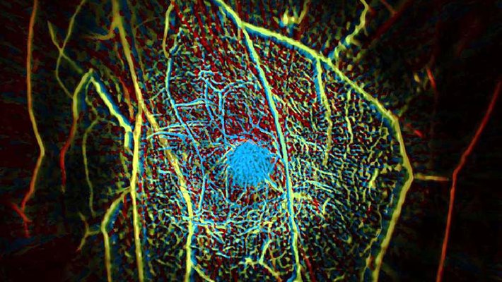A false-color image of blood vessels within human-breast tissue. 