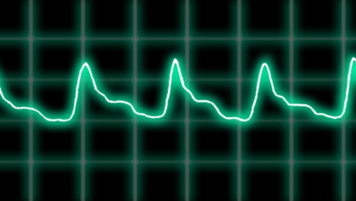 An artist's rendering of a heartbeat plotted on a graph.