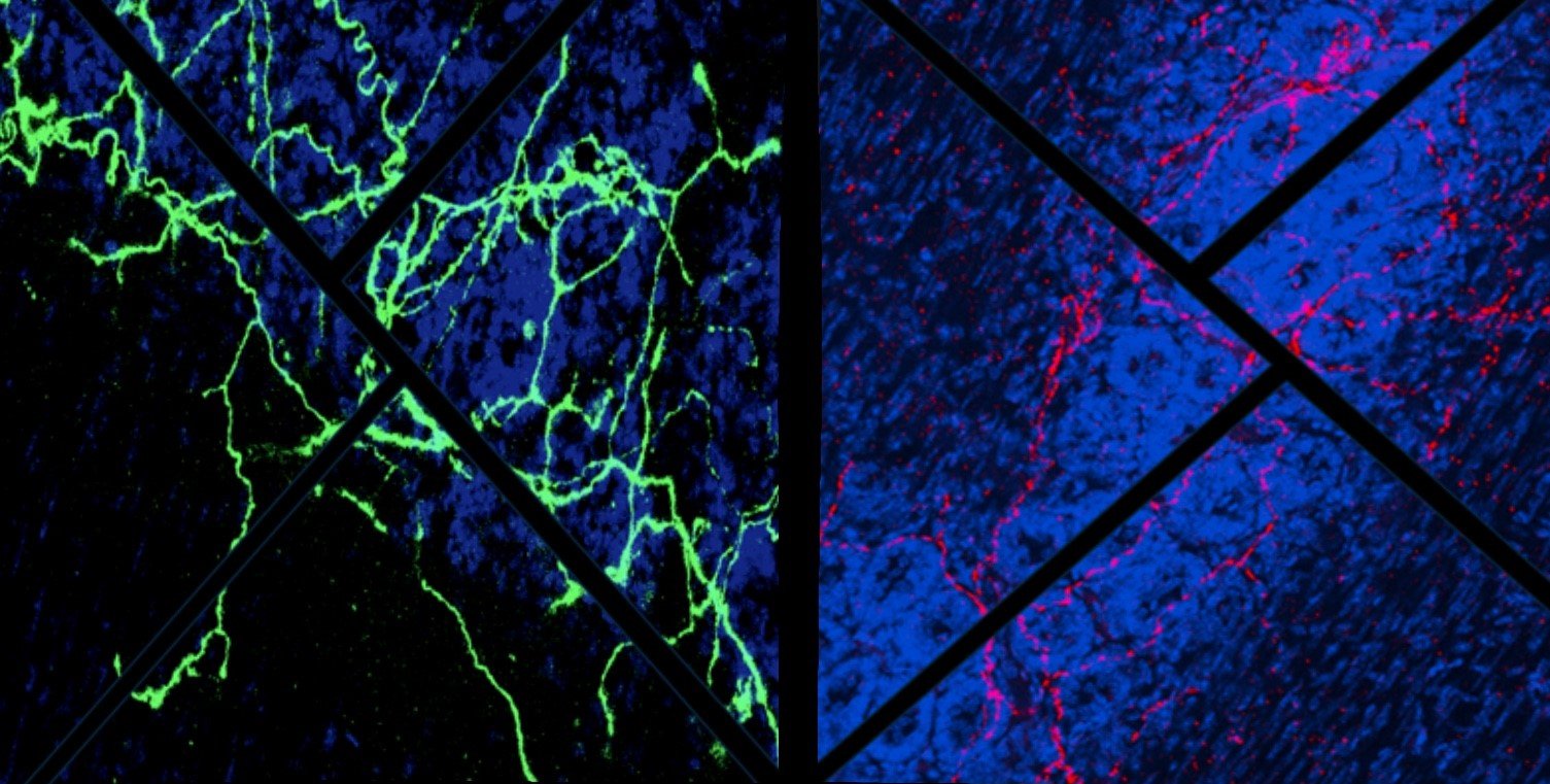 Two panels - left, a dark blue background with bright green lines; right, a dark blue background with red lines