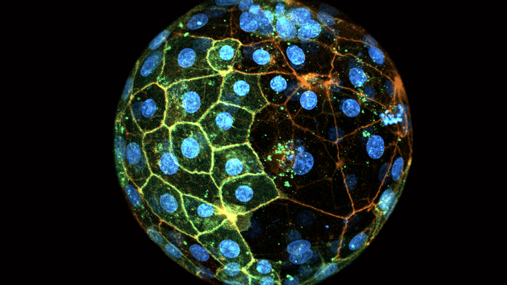 A spherical shape with bright green dots on the left hand side