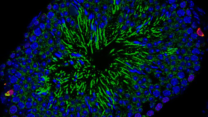 A cross-section of a seminiferous tubule, where sperm cells are formed.